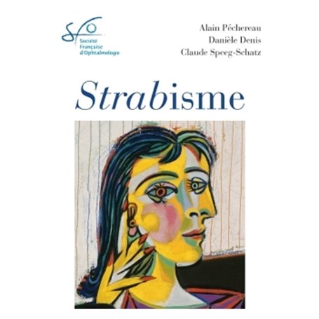 Strabisme
