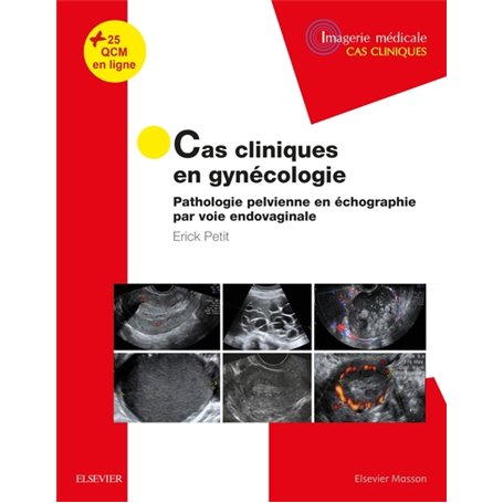 Cas cliniques en imagerie : gynécologie