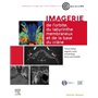 Imagerie de l'orbite, du labyrinthe membraneux et de la base du crâne