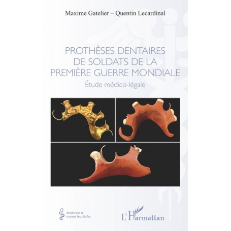 Prothèses dentaires de soldats de la Première Guerre Mondiale