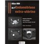 ATLAS IRM DE L'ENDOMETRIOSE EXTRA-UTERINE
