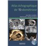 Atlas échographique de l'endométriose