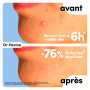 Dr. Herma - Patch Anti Bouton Invisible - Traitement Discret Rapide & Efficace de l’Acné 6 à 8h - Formule Médicale Acide Salicyl