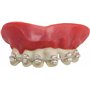 P'TIT CLOWN - Dentier Appareil Dentaire - Parfait pour Déguisement d'halloween
