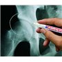 edding 8010 marqueur spécial radiologie - blanc - 1 marqueur pour radiographies - pointe fine,8 mm - pour radiographies et tomog