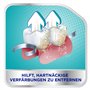 Corega TABS de nettoyage 3 minutes pour prothèses dentaires/troisième dents amovibles, 1 x 66 comprimés de nettoyage des dents