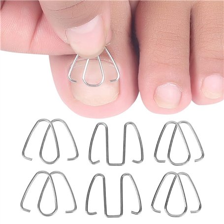 Fil de Correction D'ongle D'orteil