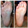 Spray Antifongique pour Chaussures - Traitement du Pied d'Athlète et des Mycoses des Ongles - Soin des Pieds Contre le - Les Cha