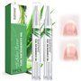 2 Pièces Huile Cuticules Ongles Stylo