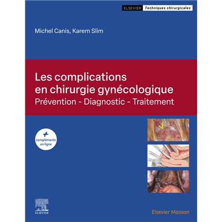 Les complications en chirurgie gynécologique