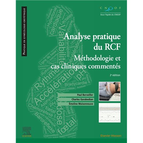 Analyse pratique du RCF : rythme cardiaque foetal
