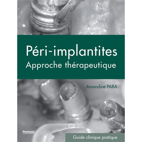 LES PÉRI-IMPLANTITES 88,06 €