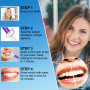 3 Pièce Stylo Blanchiment Dents - Teeth Whitening, Blanchiment Dentaire Gel Essence des Dents pour Soins des Dents Blanches