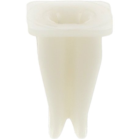 Restagraf - Écrou Plastique de Fixation Carrosserie - Spécial Carter d'Aile & Pare-boue - Compatible avec BMW