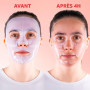 Pack de 4 Masques Bio-Collagène My SOS Beauty - 4 x 40g Masques Visage au Collagène Marin & Acide Hyaluronique - Hydratation Int