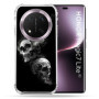Coque Renforcée Cokitec pour Honor Magic 7 Lite 5G - Tête de Mort