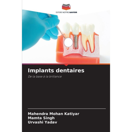 Guide Complet sur les Implants Dentaires