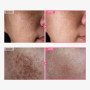 TOSOWOONG Crème Arbutine 7% + Acide Tranexamique 4%, 70000ppm Arbutine, 40000ppm TXA, Niacinamide, Glutathion, Taches, Soin visa