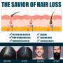Miioto Serum Pousse Cheveux, Anti Chute de Cheveux Homme, Perte de Cheveux, Pousse Cheveux Très Rapide, Hydrate Racines et Répar