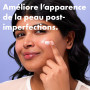 Hero Cosmetics - Rescue Balm Original - Baume Hydratant Réparateur Post-Imperfections - Améliore l’apparence des marques laissée