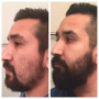 Kit de Croissance de Barbe VIKICON, Rouleau de Derma à barbe + Huile de Sérum de Croissance de Barbe + Baume à Barbe, Cadeau Par