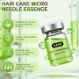 AlphaInfuse Système de croissance des cheveux, solution de repousse des cheveux, solution d'infusion à micro-aiguilles Alpha Inf