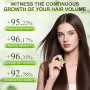AlphaInfuse Système de croissance des cheveux, solution de repousse des cheveux, solution d'infusion à micro-aiguilles Alpha Inf