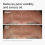 The Ordinary Niacinamide 10% + Zinc 1%, Brightening & Smoothing Serum for Blemish-Prone Skin, 30ml