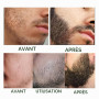 Spray Pousse Barbe Coffret Soin de La Barbe, Kit Croissance Barbe, Beard Oil Growth, Barbe Dermaroller, Kit Sérum Huile Barbe De